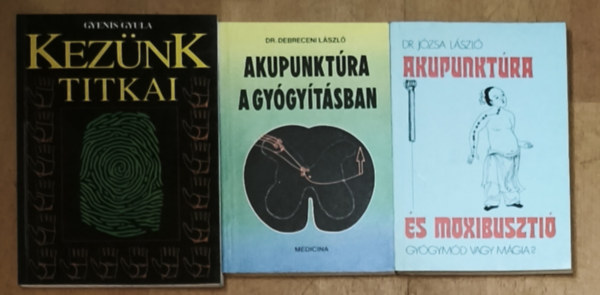 Gyenis Gyula, Dr. Józsa László, Dr. Debreceni László: 3db akupunktúrával kapcsolatos kézikönyv - Akupunktúra a gyógyításban, Akupunktúra és moxibusztió, Kezünk titkai antikvár