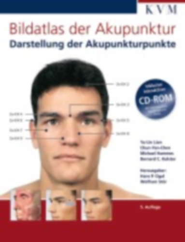 Yan-Chen, Chun - Lian, Yu-Lin - Hammes, Michael - Kolster, Bernhard C.: Bildatlas der Akupunktur idegen