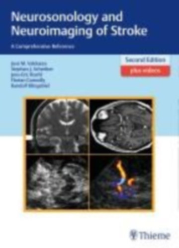 Connolly, Florian - Röhl, Jens-Eric - Valdueza, José Manuel - Schreiber, Stephan - Klingebiel, Randolf: Neurosonology and Neuroimaging of Stroke idegen