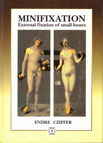 Cziffer Endre: Minifixation: External Fixation of Small Bones antikvár