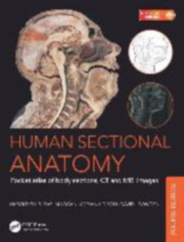 Bowden, David J - Ellis, Harold - Dixon, Adrian Kendal - Logan, Bari M: Human Sectional Anatomy idegen