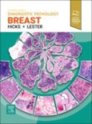 Lester, Susan C. - Hicks, David G.: Diagnostic Pathology: Breast idegen