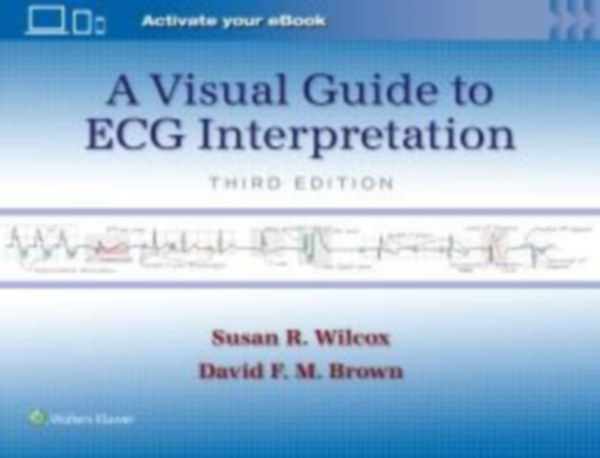 Brown, David F. M. - Wilcox, Susan Renee: A Visual Guide to ECG Interpretation: Print + eBook with Multimedia idegen