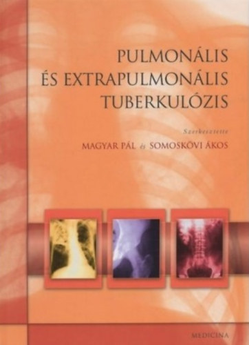 Magyar Pál - Somoskövi Ákos: Pulmonális és extrapulmonális tuberkolózis antikvár