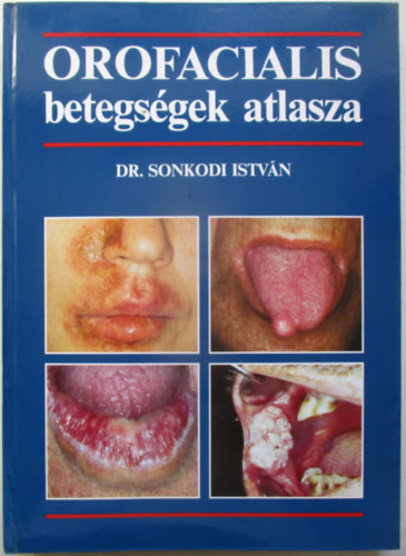 Dr. Sonkodi István: Orofacialis betegségek atlasza antikvár