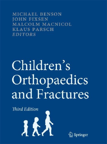 Benson, Michael: Children's Orthopaedics and Fractures idegen