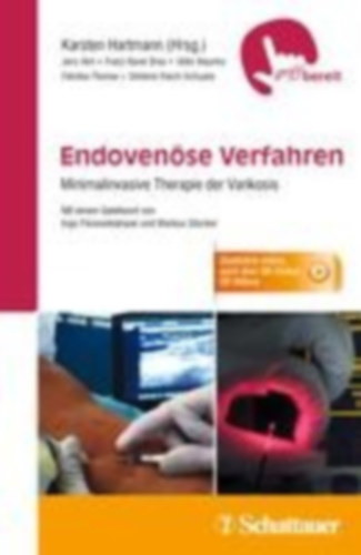 Alm, Jens - Breu, Franz-Xaver - Maurins, Uldis - Pannier, Felizitas - Reich-Schupke, Stefanie: Endovenöse Verfahren idegen