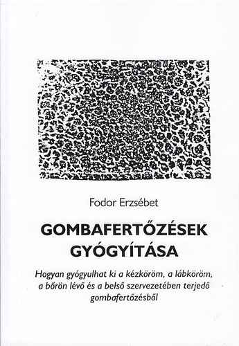 Fodor Erzsébet: Gombafertőzések gyógyítása antikvár