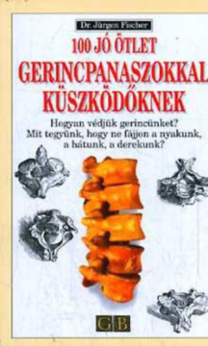 Jürgen Dr. Fischer: 100 jó ötlet gerincpanaszokkal küszködőknek antikvár