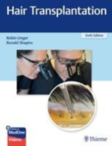 Hair Transplantation idegen