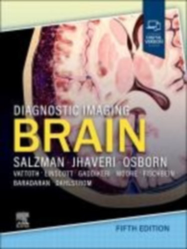Jhaveri, Miral D - Salzman, Karen L: Diagnostic Imaging: Brain, idegen