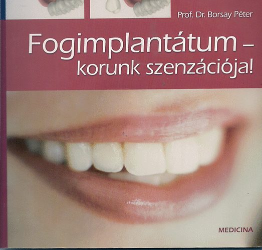 Prof. Dr. Borsay Péter: Fogimplantátum-korunk szenzációja! antikvár