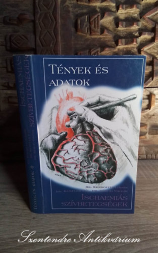 Dr. Kerkovits Gábor, Dr. Kempler Pál, Dr. Bérczi Viktor, Dr. Makara Mihály (szerk.), Dr. Váradi András (lektor): Tények és adatok - Ischaemiás szívbetegségek (A szívizom ichaemia kialakulása, következményei, klinikai megjelenési formái) Saját képpel! antikvár