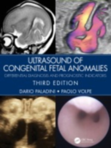 Paladini, Dario - Volpe, Paolo: Ultrasound of Congenital Fetal Anomalies idegen