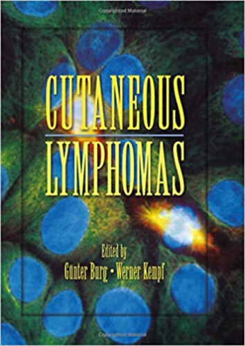 Günter Burg, Werner Kempf: Cutaneous Lymphomas antikvár