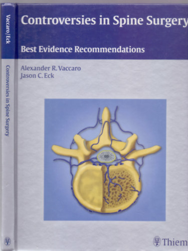 Alexander R. Vaccaro MD. PhD. FACS - Jason C. Eck DO. MS.: Controversies in Spine Surgery: Best Evidence Recommendations antikvár