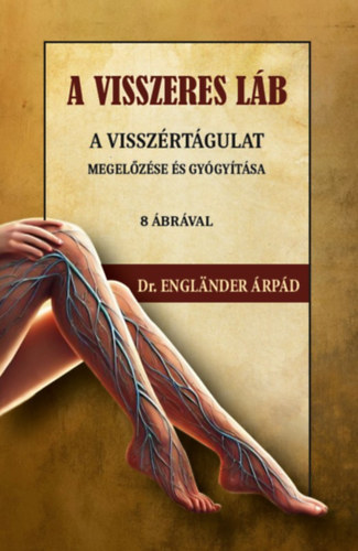 A visszeres láb a visszértágulat megelőzése és gyógyítása akciós termékkép 1