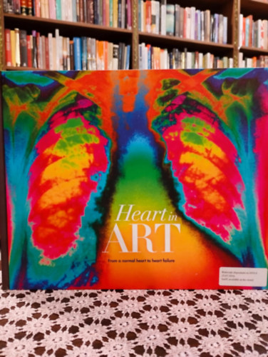 Thomas F. Lüscher: Hart in art. From a normal heart to heart failure. /Az egészséges szívtől a szívelégtelenségig/ antikvár