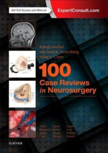 Chen, Mike Y - Aizenberg, Michele R - Jandial, Rahul: 100 Case Reviews in Neurosurgery idegen