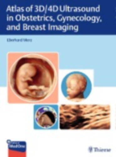 Merz, Eberhard: Atlas of 3D/4D Ultrasound in Obstetrics, Gynecology, and Breast Imaging idegen