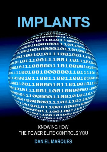 Implants