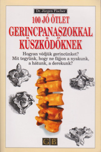 Dr. Jürgen Fischer: 100 jó ötlet gerincpanaszokkal küszködőknek antikvár