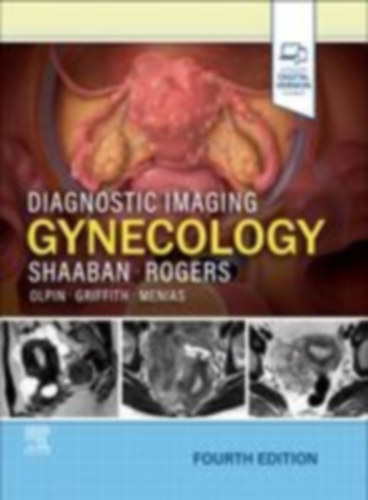 Rogers, Douglas - Shaaban, Akram M: Diagnostic Imaging: Gynecology idegen