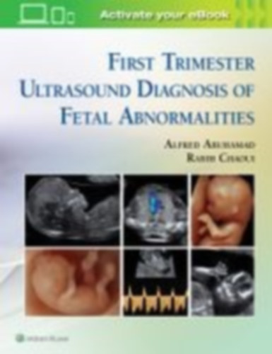 Chaoui, Rabih - Abuhamad, Alfred: First Trimester Ultrasound Diagnosis of Fetal Abnormalities idegen